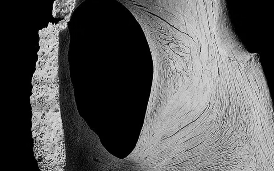 Osteopenia e hidratación